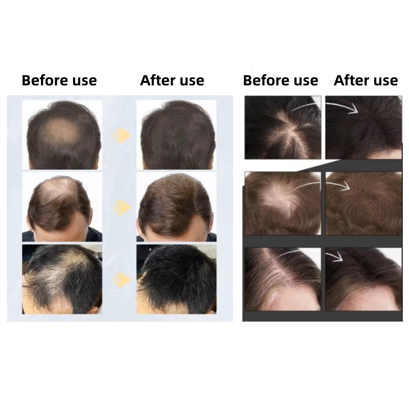 20pcsHair Fiber Keratin Hair B - Hair Care Natural Products 评论和价格