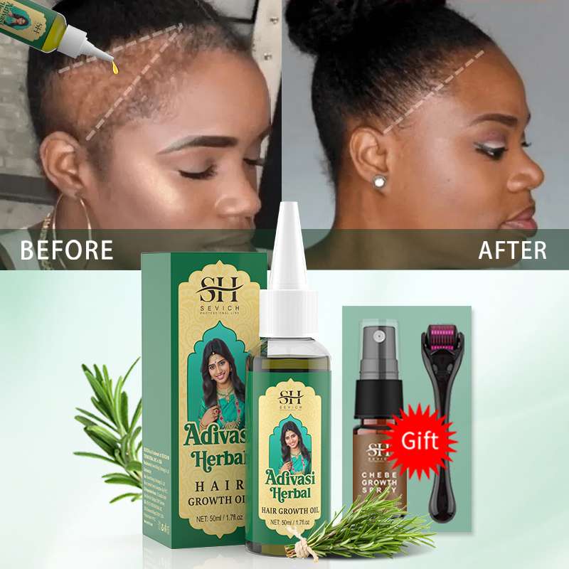 Ayurvedic Hair Growth Oil Indi - Hair Care Fragrance Essential Oil 评论和价格