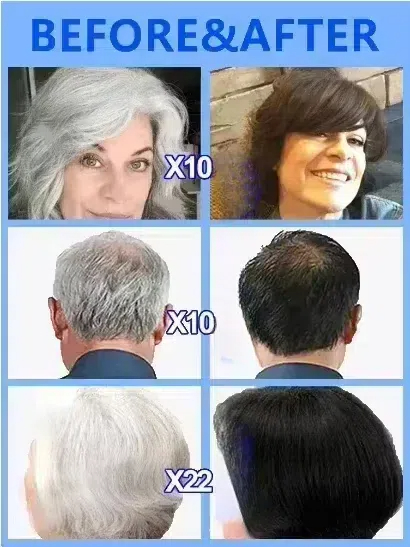 restore natural hair color in  - Hair Care Natural Products 评论和价格