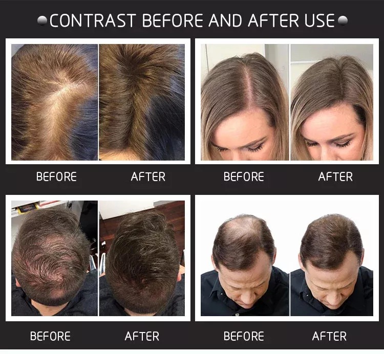 28g Hair Building Fibers Come  - Hair Care Natural Products 评论和价格