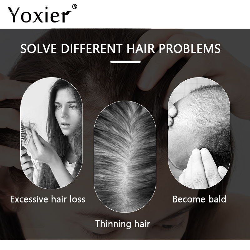 Intensive Growth Serum Prevent - Hair Care For Hair Loss 评论和价格