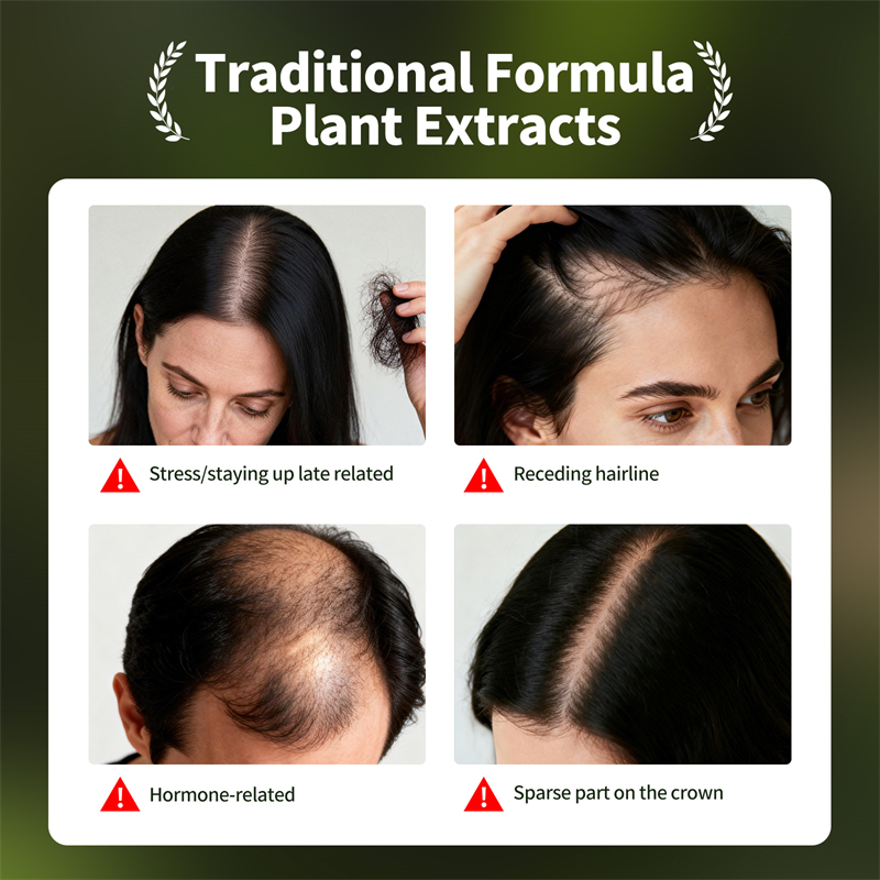 Natural Hair Growth Set Usman  - Hair Care Natural Products 评论和价格
