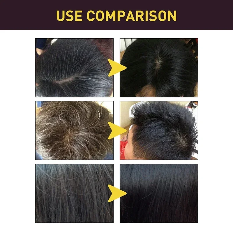 100ml Black Color Hair Dyeing  - Hair Care Loreal 评论和价格