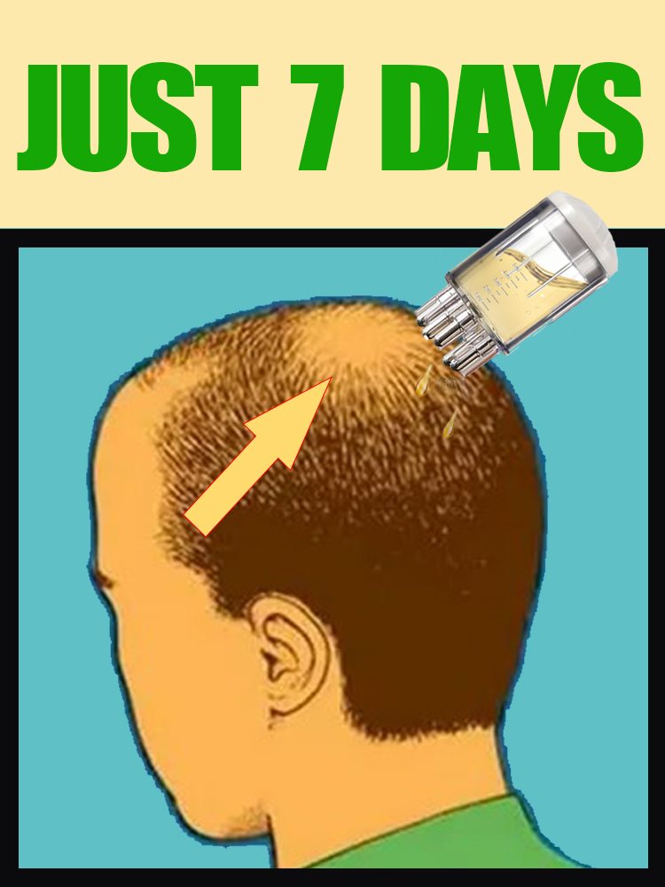 2025 NEW UPGRADE Scalp Applica - Hair Care Oil Serum 评论和价格