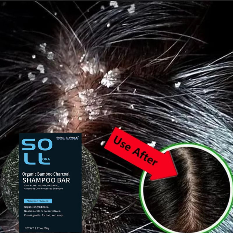 Fast Anti Dandruff Hair Treatm - Hair Care Dandruff 评论和价格