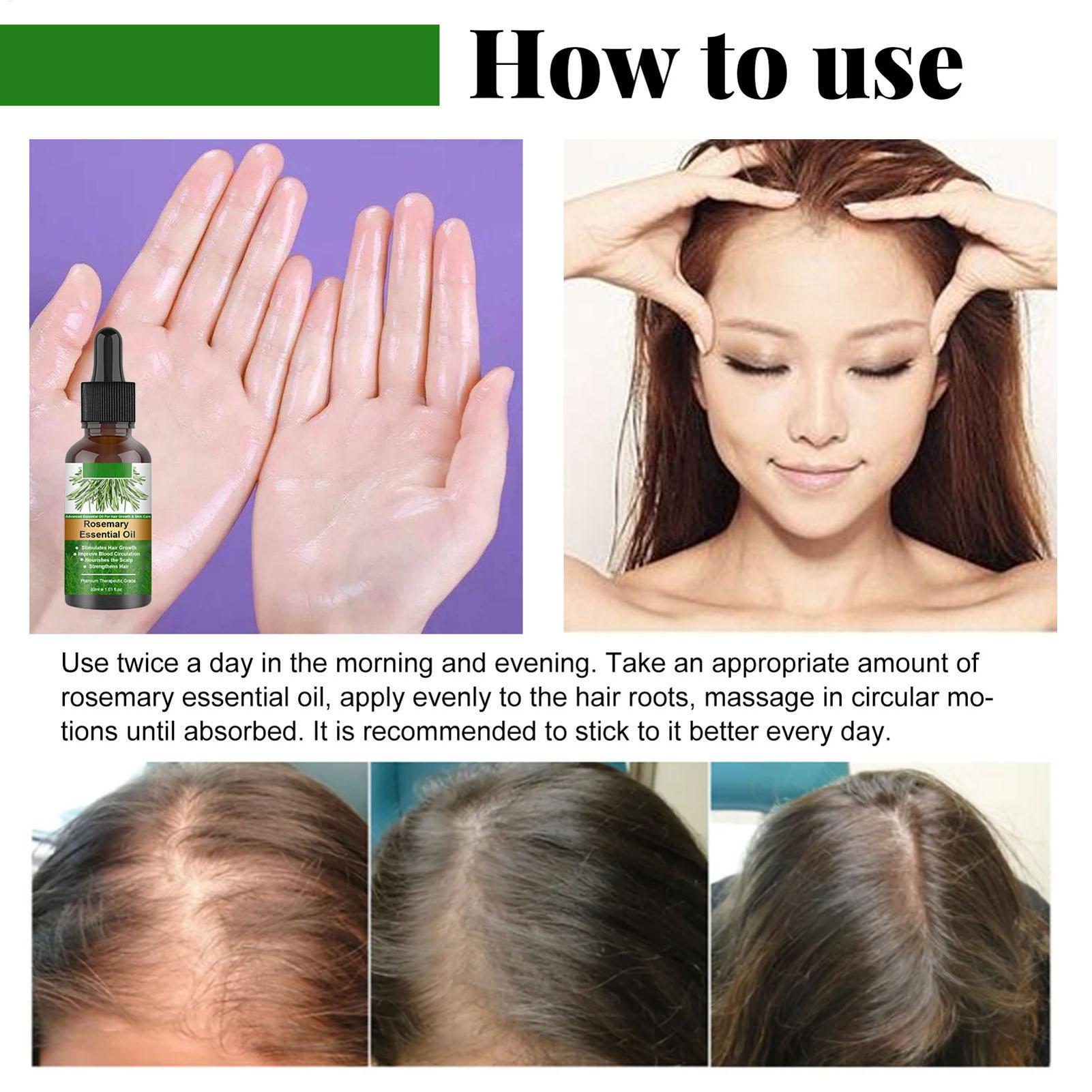 Rosemary Essential Oil Hair Gr - Hair Care Natural Products 评论和价格