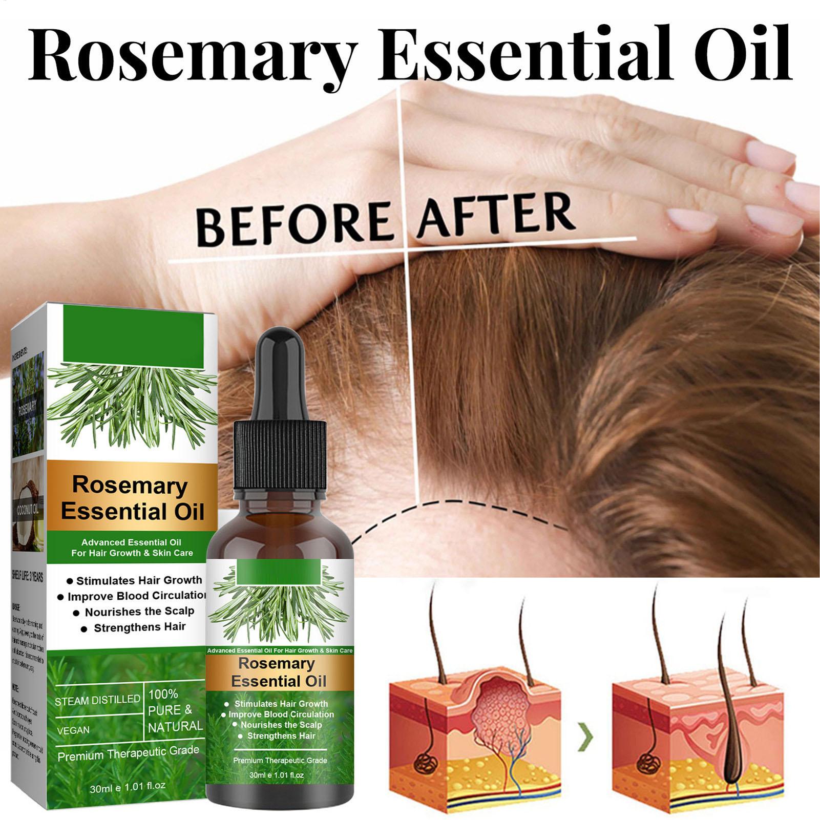 Rosemary Essential Oil Hair Gr - Hair Care Natural Products 评论和价格