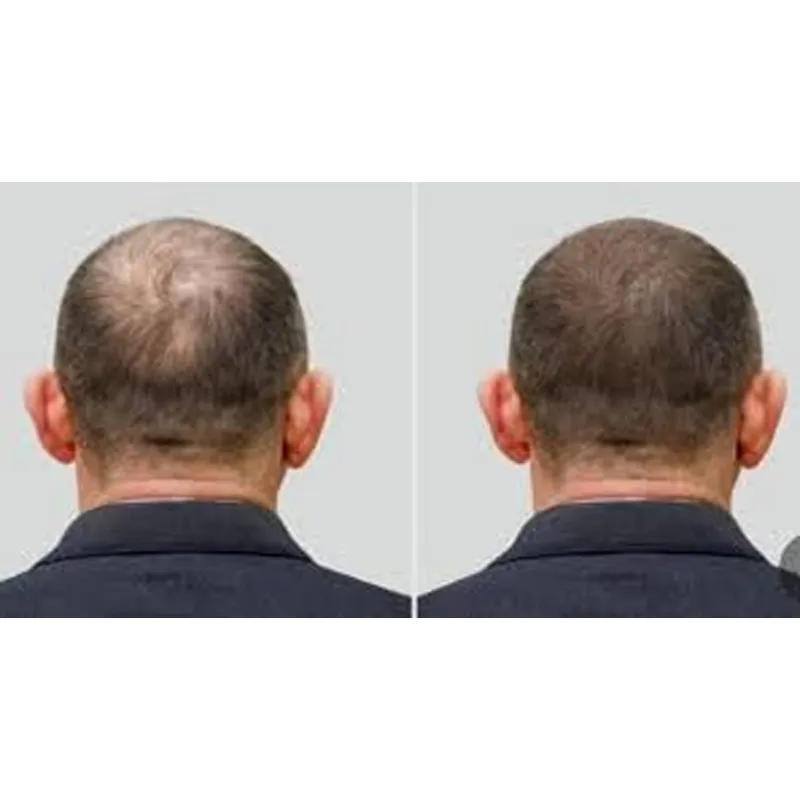 Good Seal Ozone Cap Ozone Hat  - Hair Care Good Hair 评论和价格