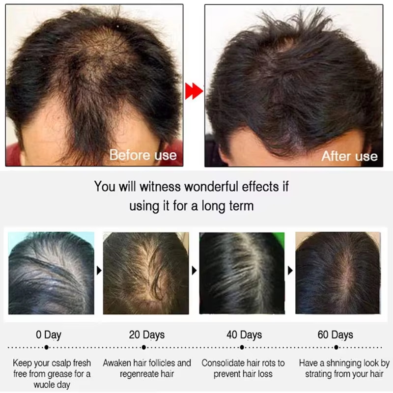 Fast Ginger Hair Growth Spray  - Hair Care Natural Products 评论和价格