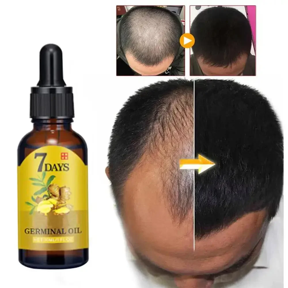 Hair Growth Ginger Fast Growin - Hair Care Fragrance Essential Oil 评论和价格