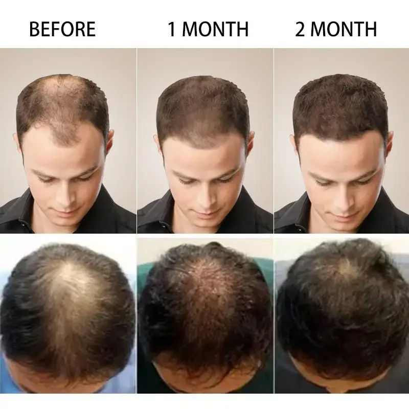 Hair Growth Ginger Fast Growin - Hair Care Fragrance Essential Oil 评论和价格