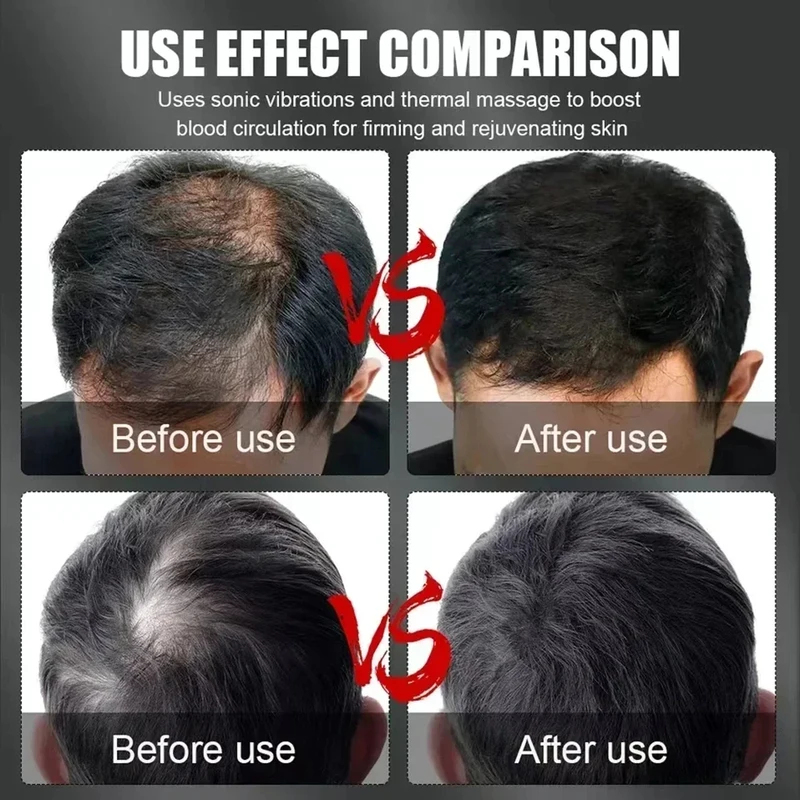 660nm 850nm Red Light Infrared - Hair Care For Hair Loss 评论和价格